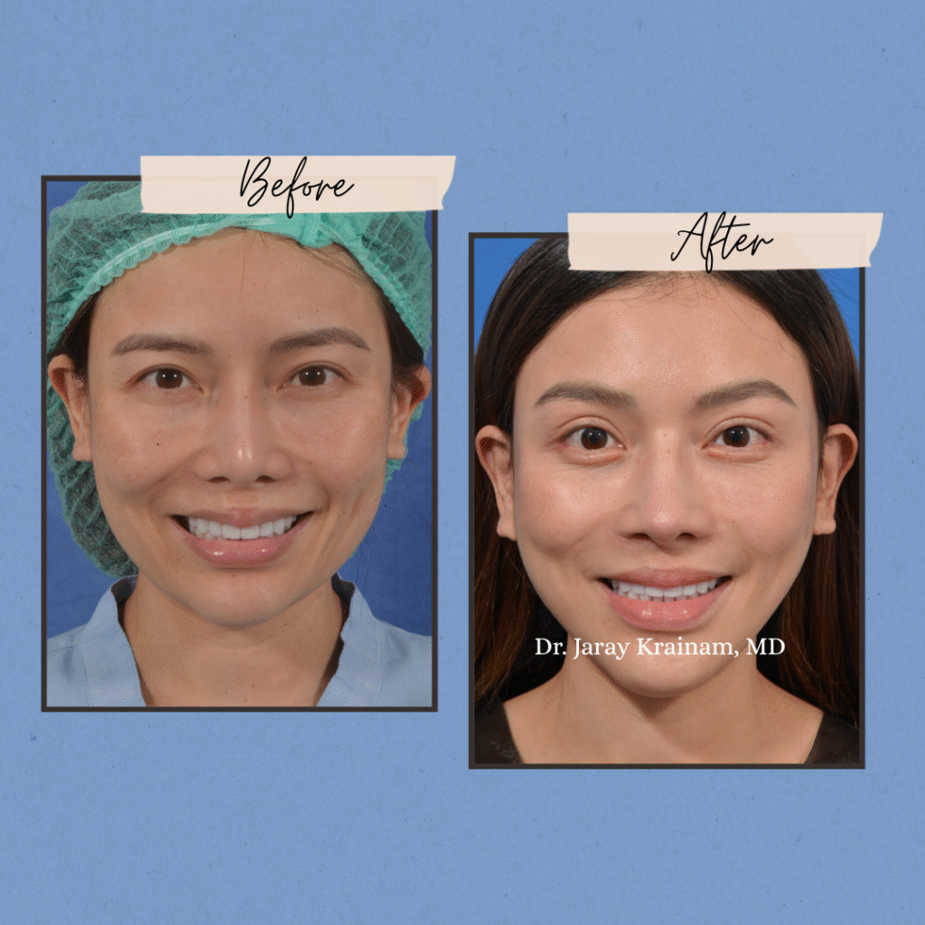 103 - Dr. Jaray Cosmetic Surgery