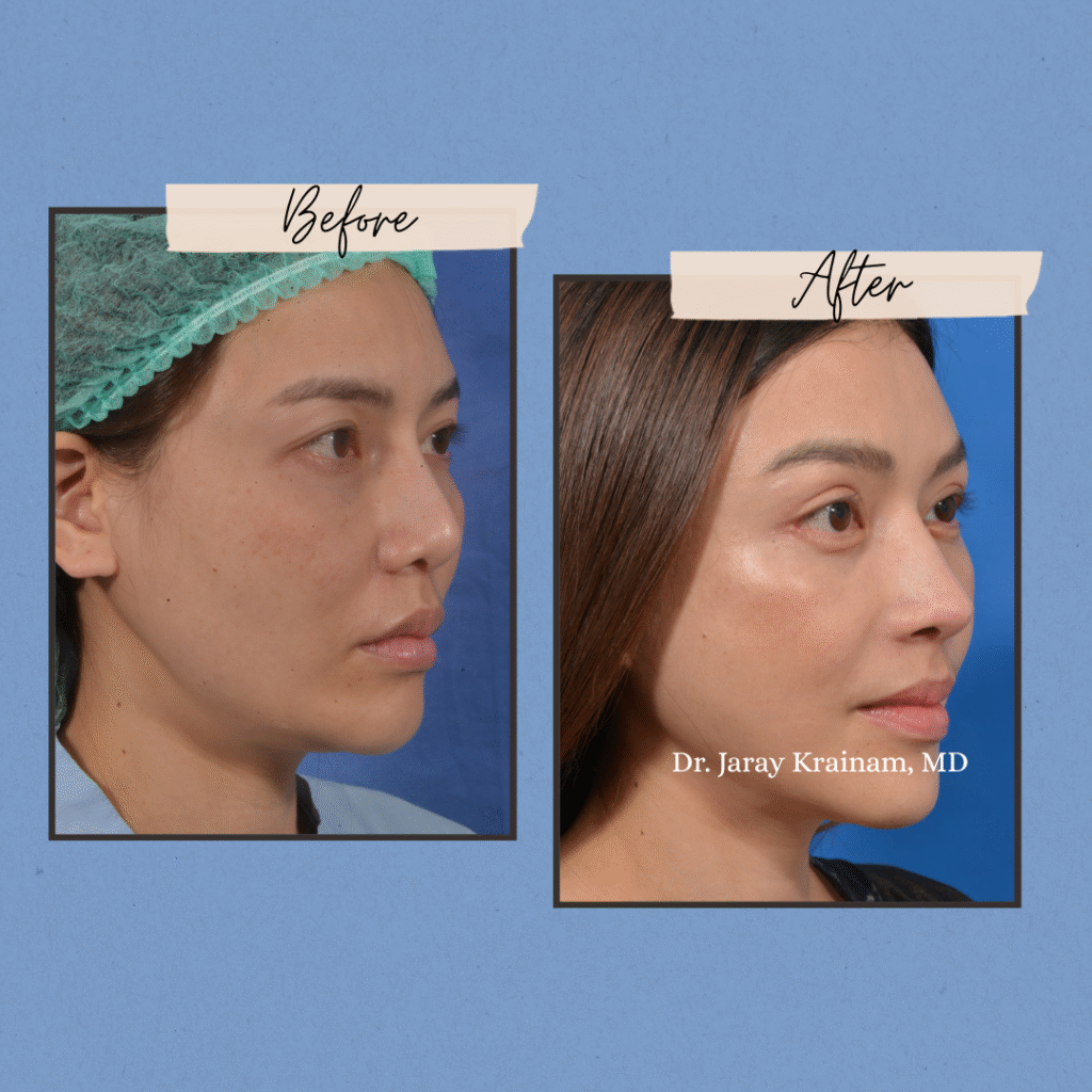 104 - Dr. Jaray Cosmetic Surgery