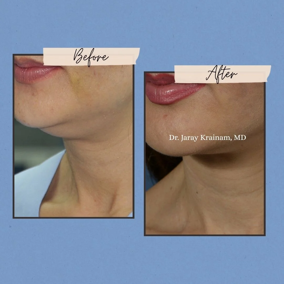 112 - Dr. Jaray Cosmetic Surgery