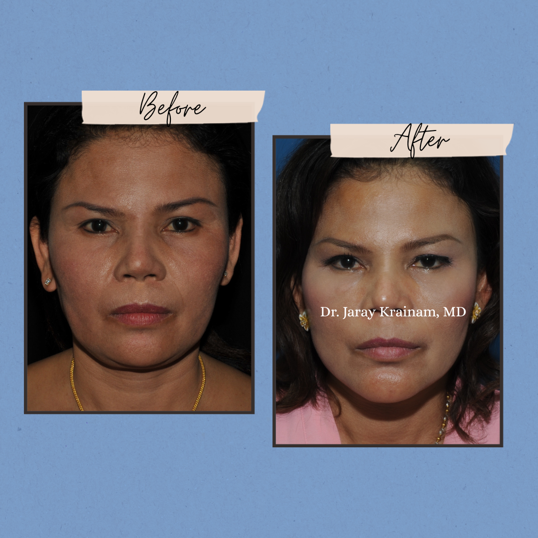 136 - Dr. Jaray Cosmetic Surgery