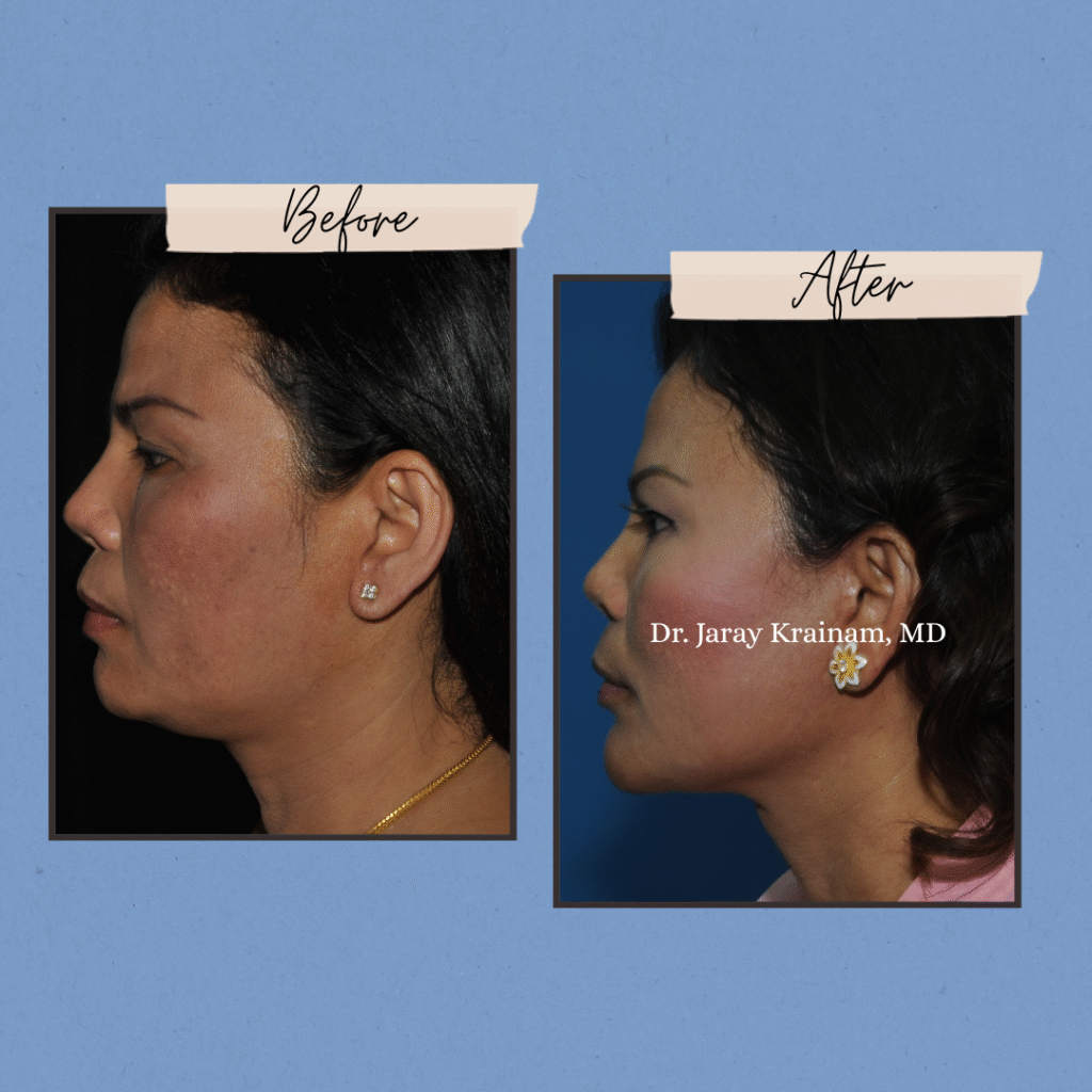 138 - Dr. Jaray Cosmetic Surgery