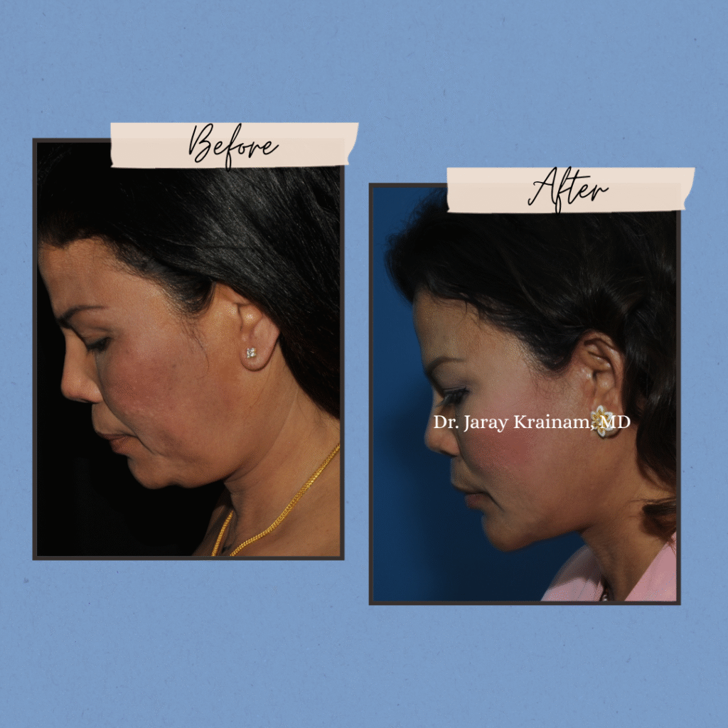 139 - Dr. Jaray Cosmetic Surgery