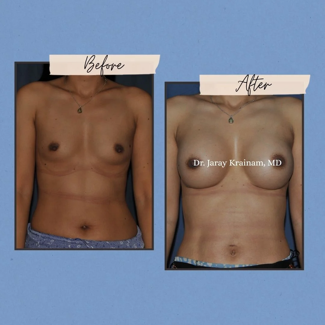 34 - Dr. Jaray Cosmetic Surgery