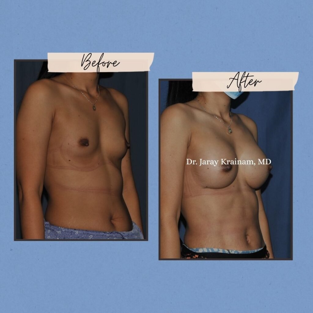 36 - Dr. Jaray Cosmetic Surgery