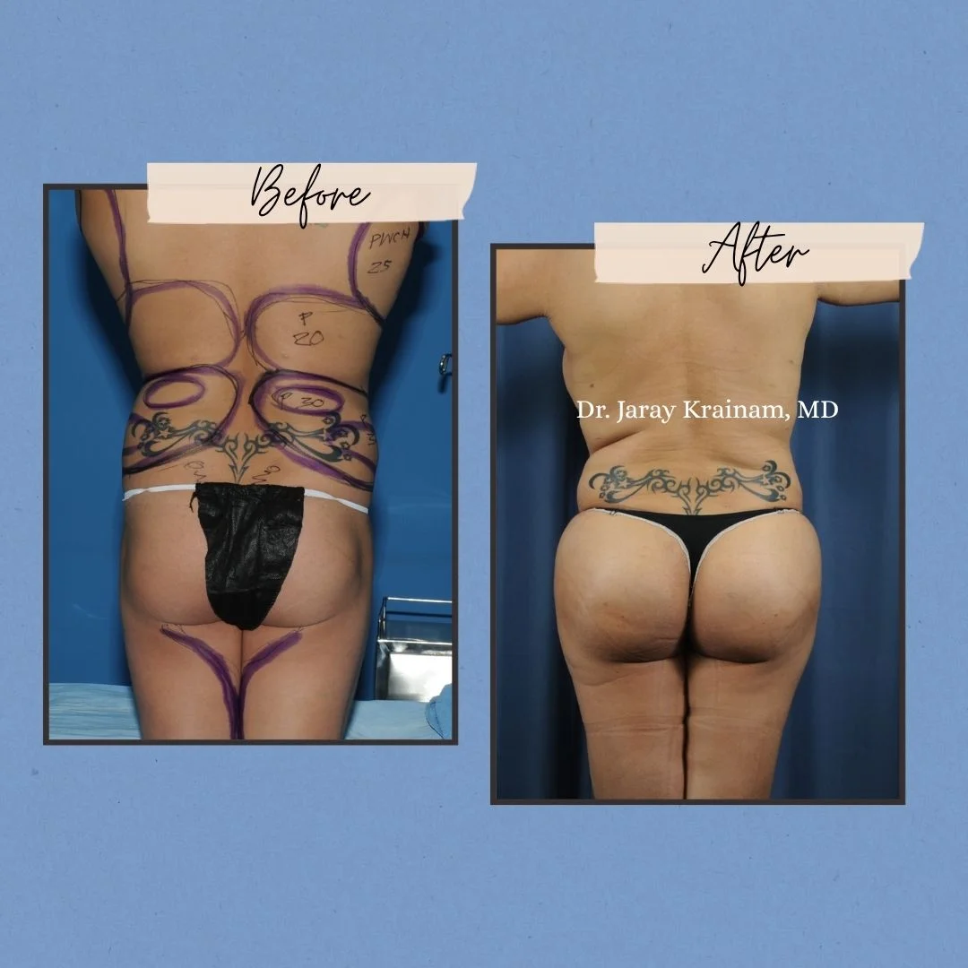 46 - Dr. Jaray Cosmetic Surgery