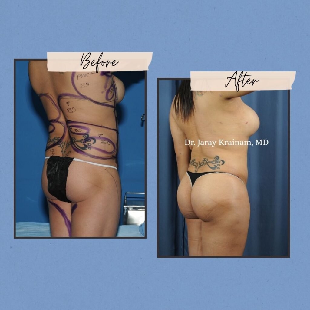 47 - Dr. Jaray Cosmetic Surgery