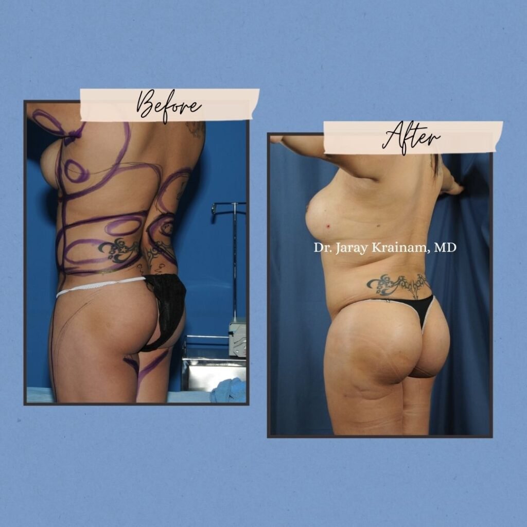 48 - Dr. Jaray Cosmetic Surgery