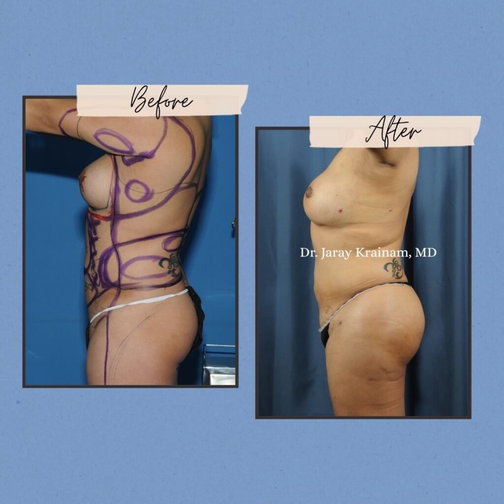 49 - Dr. Jaray Cosmetic Surgery