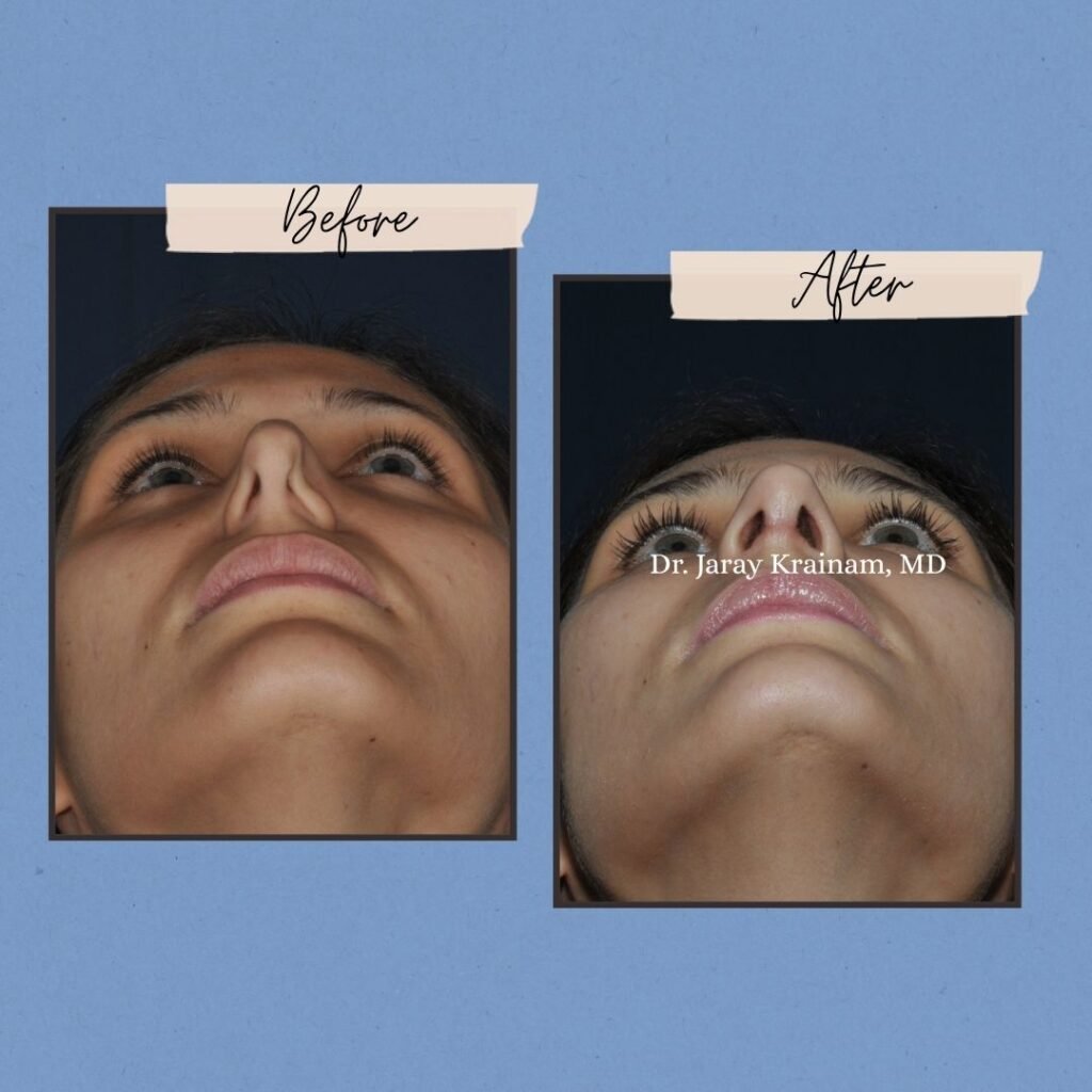 5 - Dr. Jaray Cosmetic Surgery