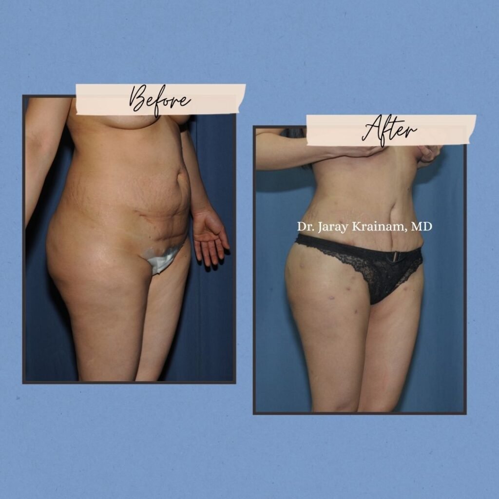 55 - Dr. Jaray Cosmetic Surgery