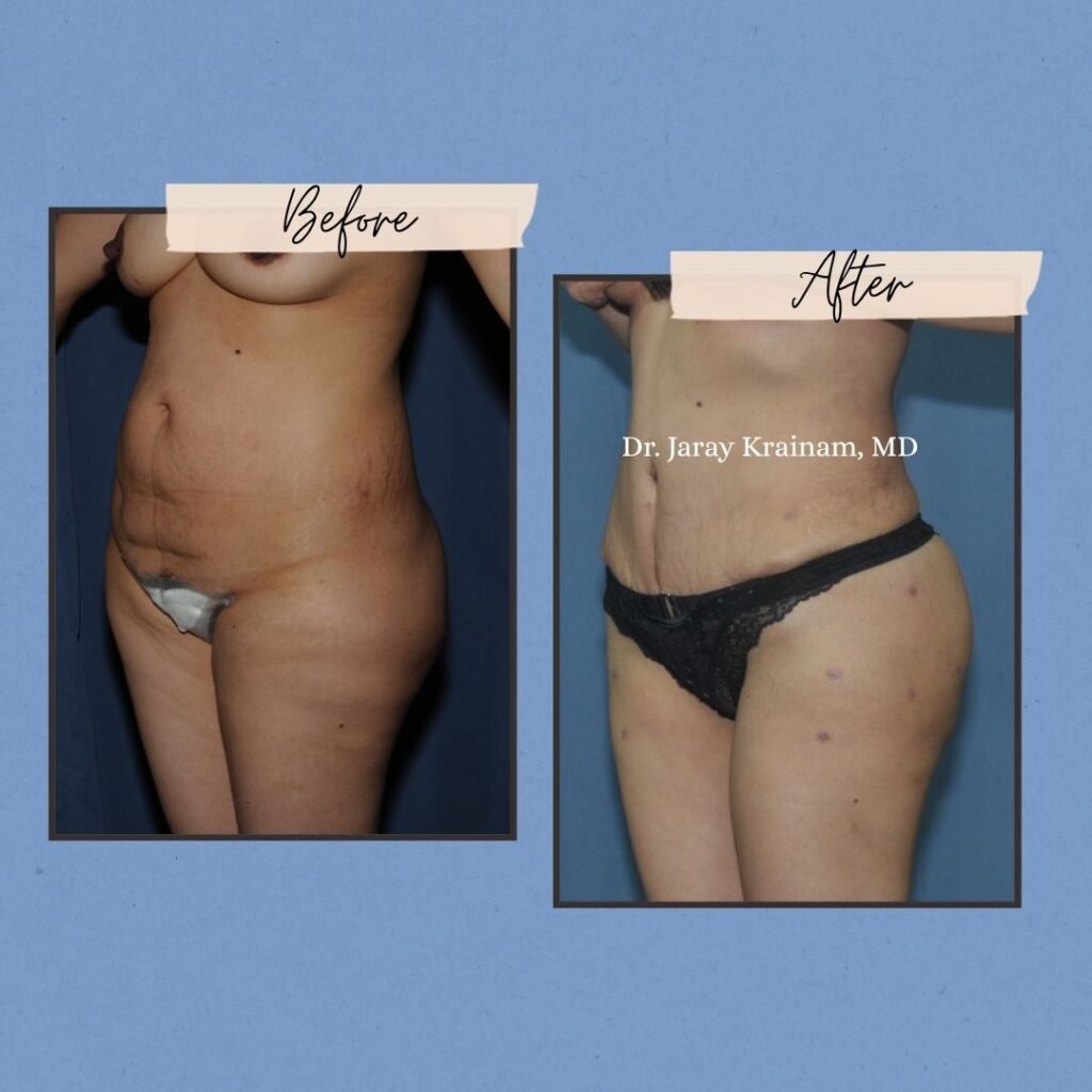 57 - Dr. Jaray Cosmetic Surgery