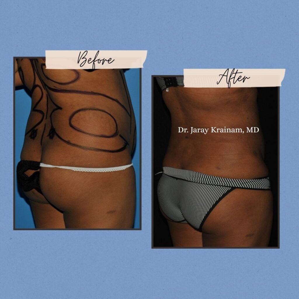 61 - Dr. Jaray Cosmetic Surgery