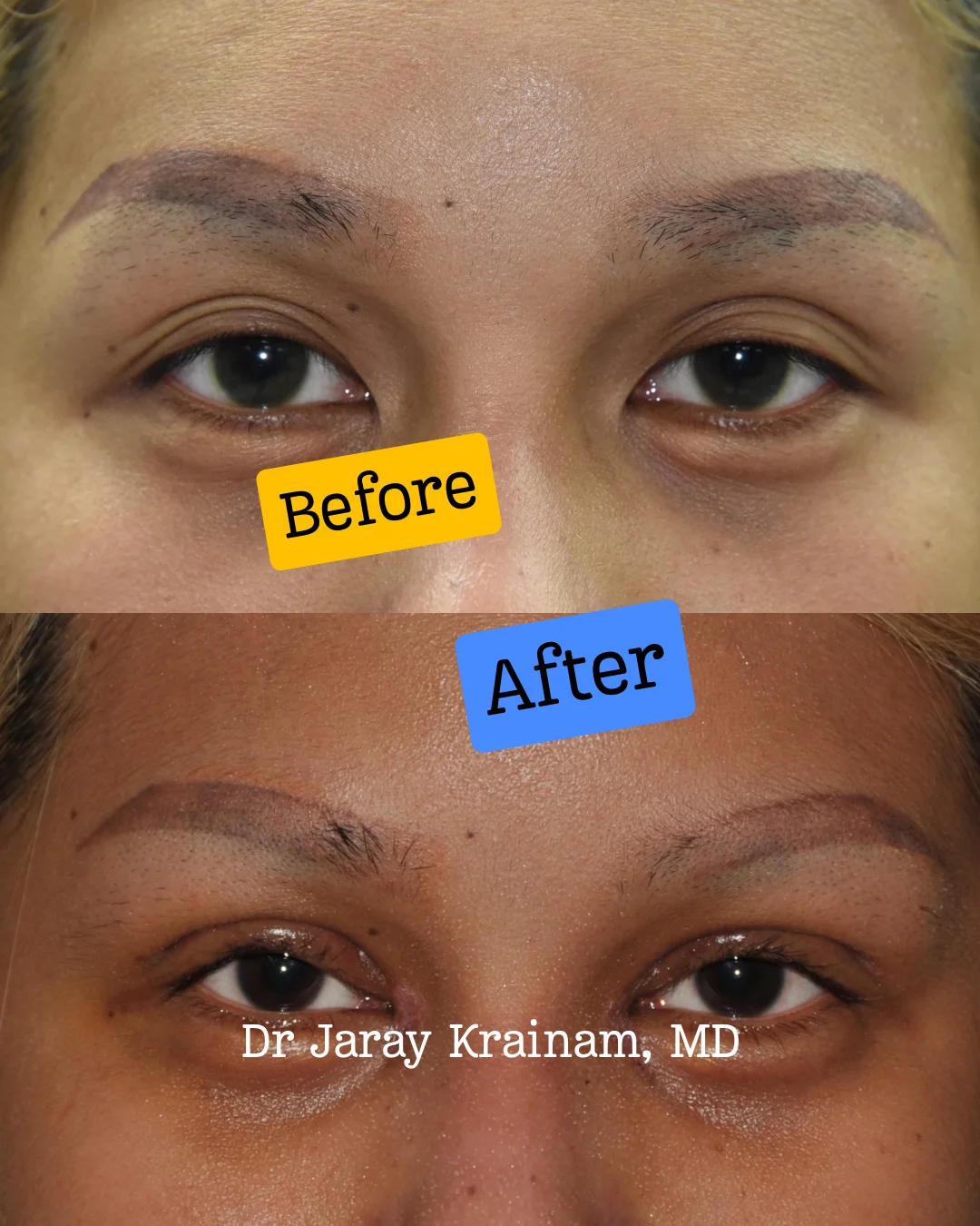Simple-Minimalist-Photography-Exhibition-Photo-Collage-Instagram-Post-1 1 - Dr. Jaray Cosmetic Surgery
