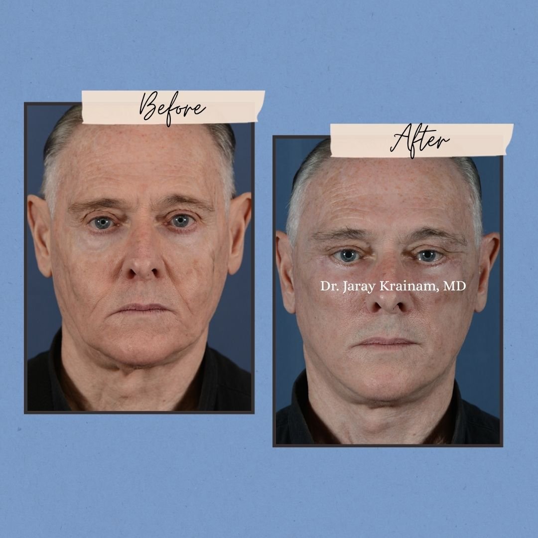 114 - Dr. Jaray Cosmetic Surgery