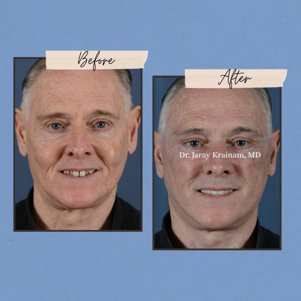 115 - Dr. Jaray Cosmetic Surgery