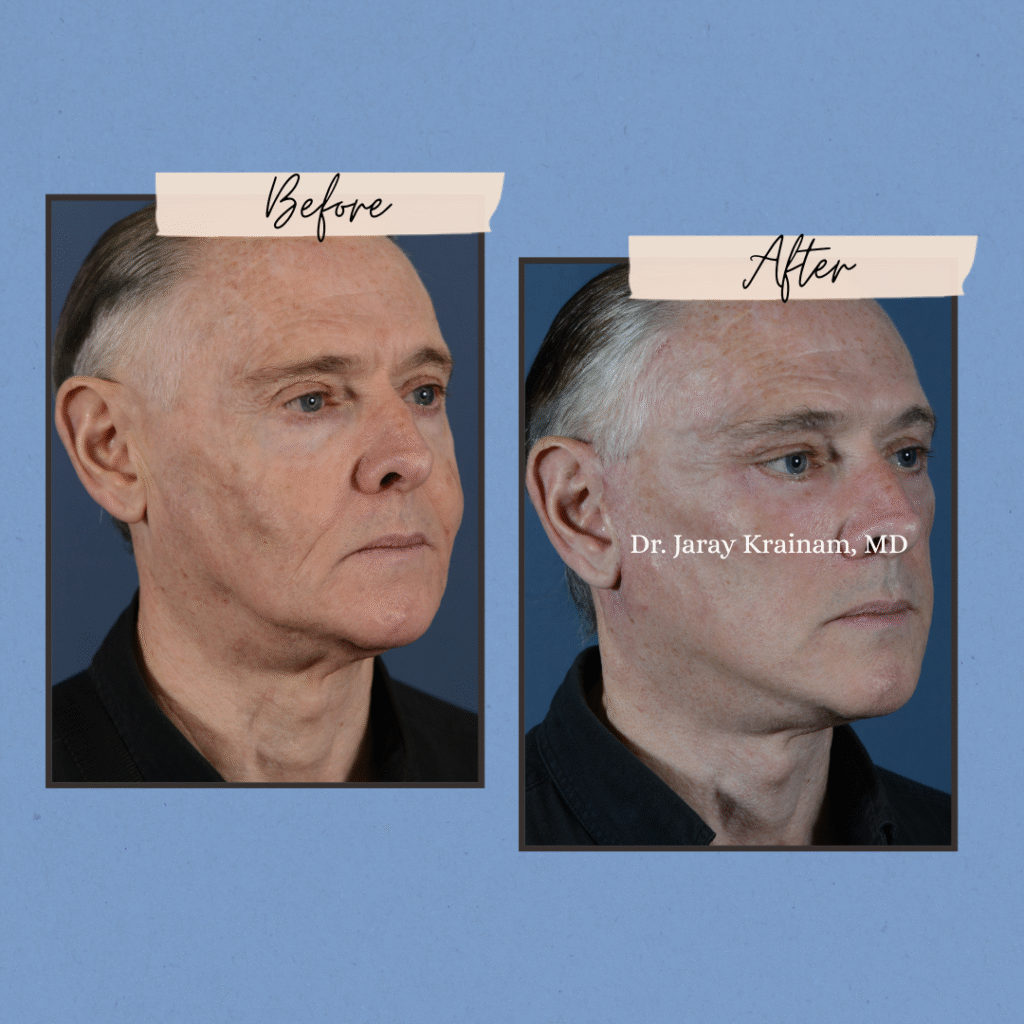 142 - Dr. Jaray Cosmetic Surgery