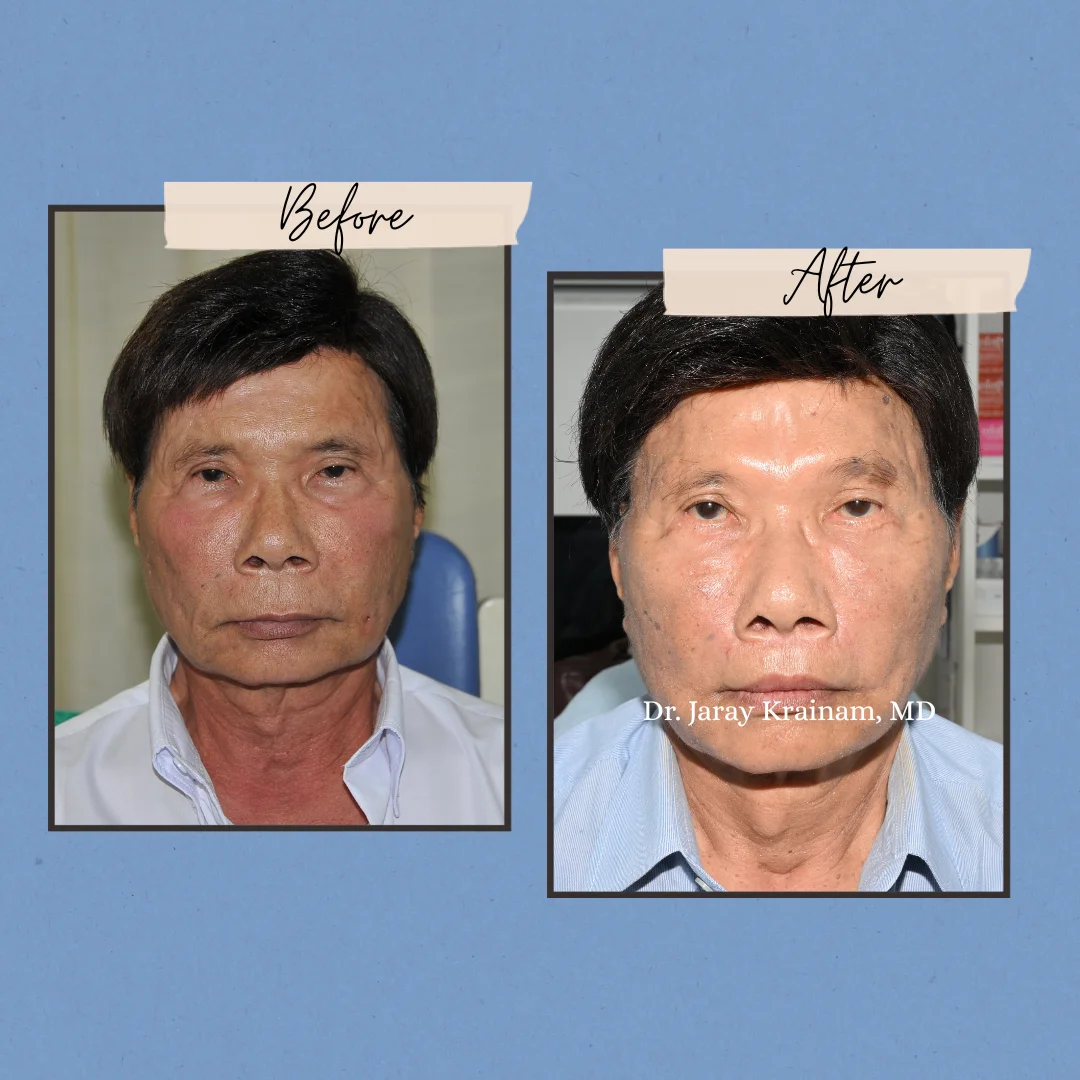 187 - Dr. Jaray Cosmetic Surgery