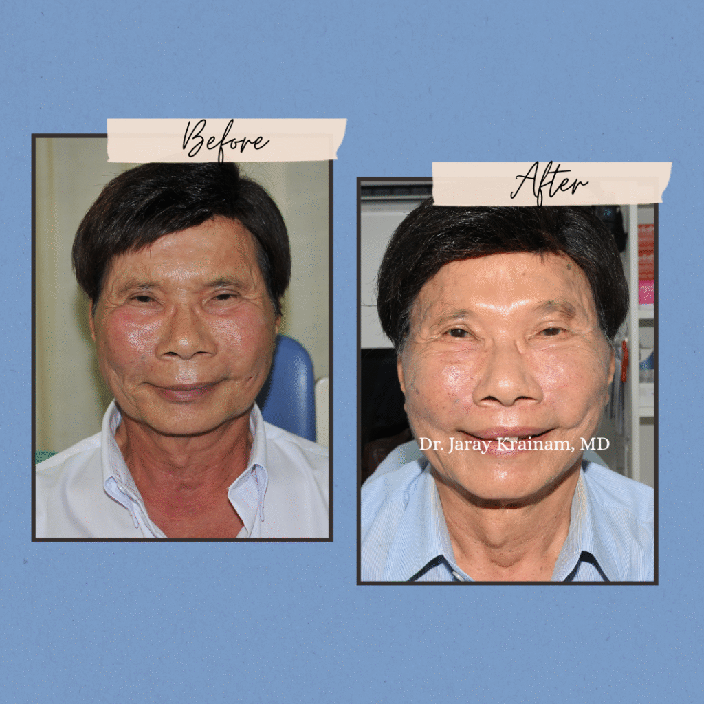 188 - Dr. Jaray Cosmetic Surgery