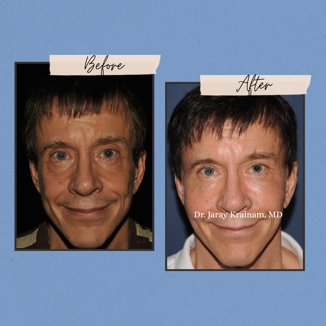 199 - Dr. Jaray Cosmetic Surgery