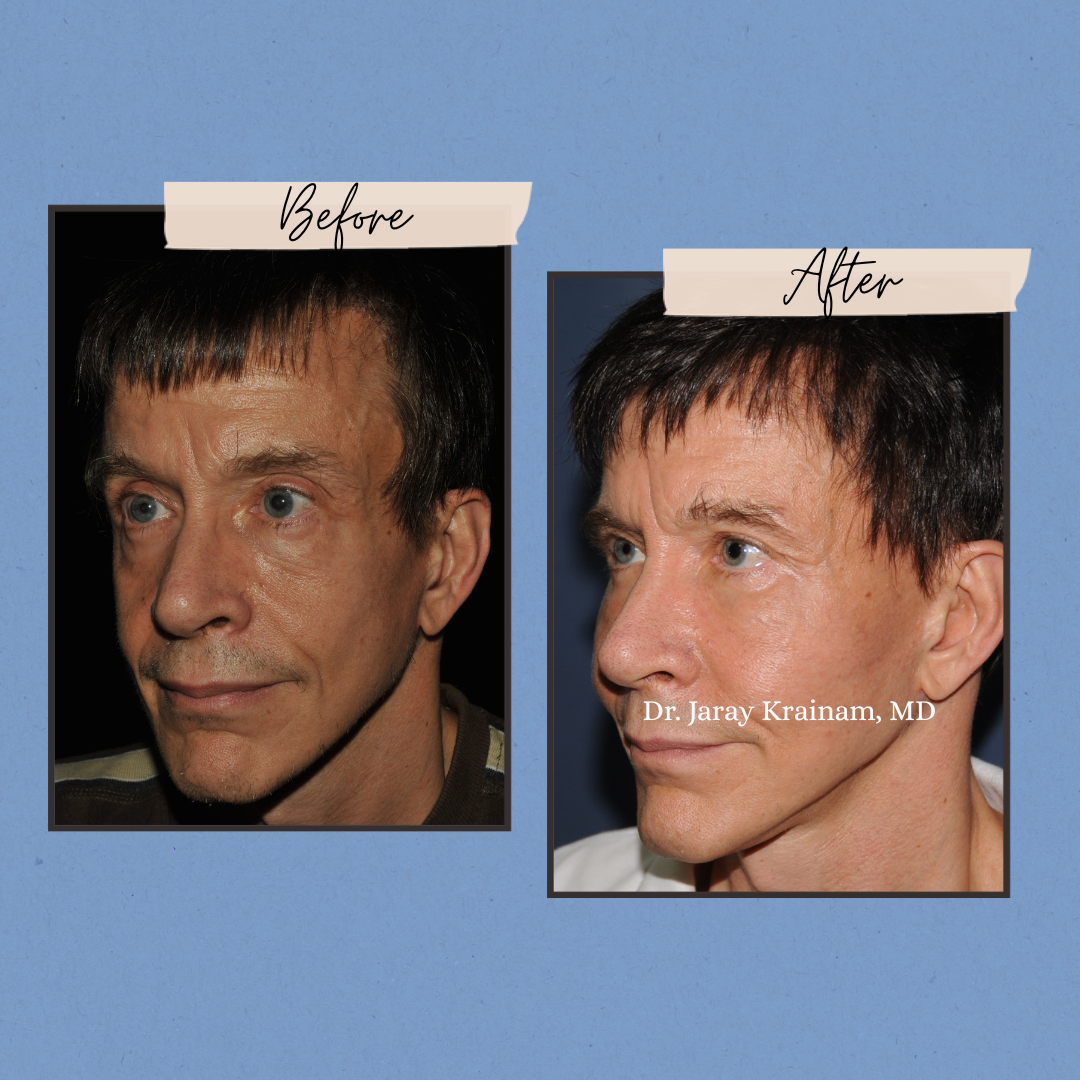 200 - Dr. Jaray Cosmetic Surgery