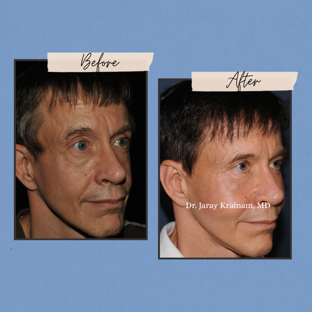 201 - Dr. Jaray Cosmetic Surgery
