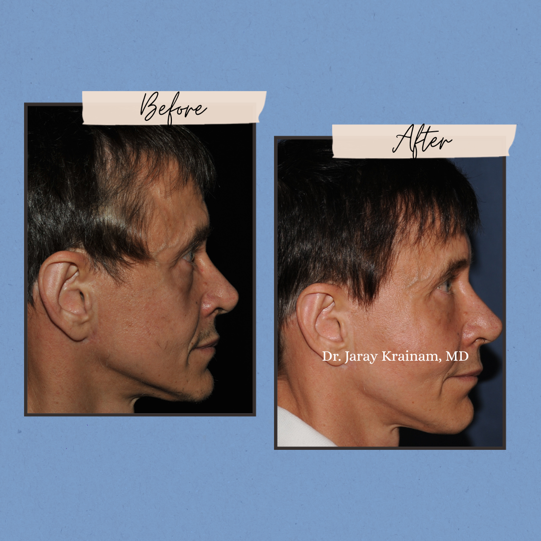 202 - Dr. Jaray Cosmetic Surgery