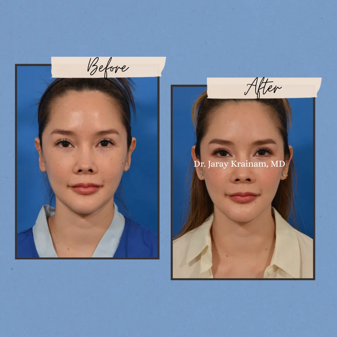 216 - Dr. Jaray Cosmetic Surgery