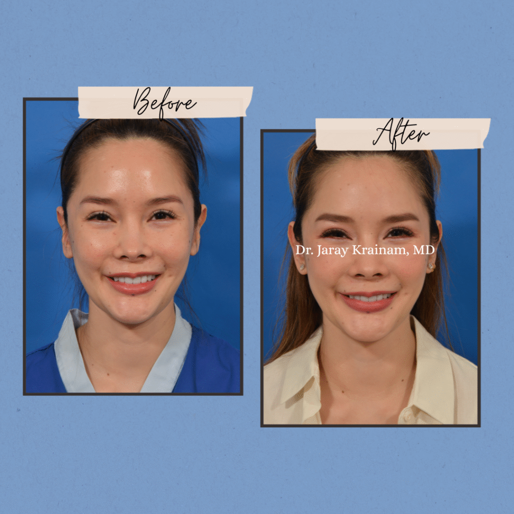 217 - Dr. Jaray Cosmetic Surgery