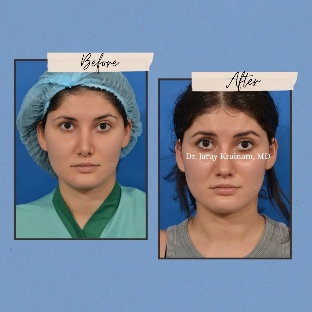 250 - Dr. Jaray Cosmetic Surgery