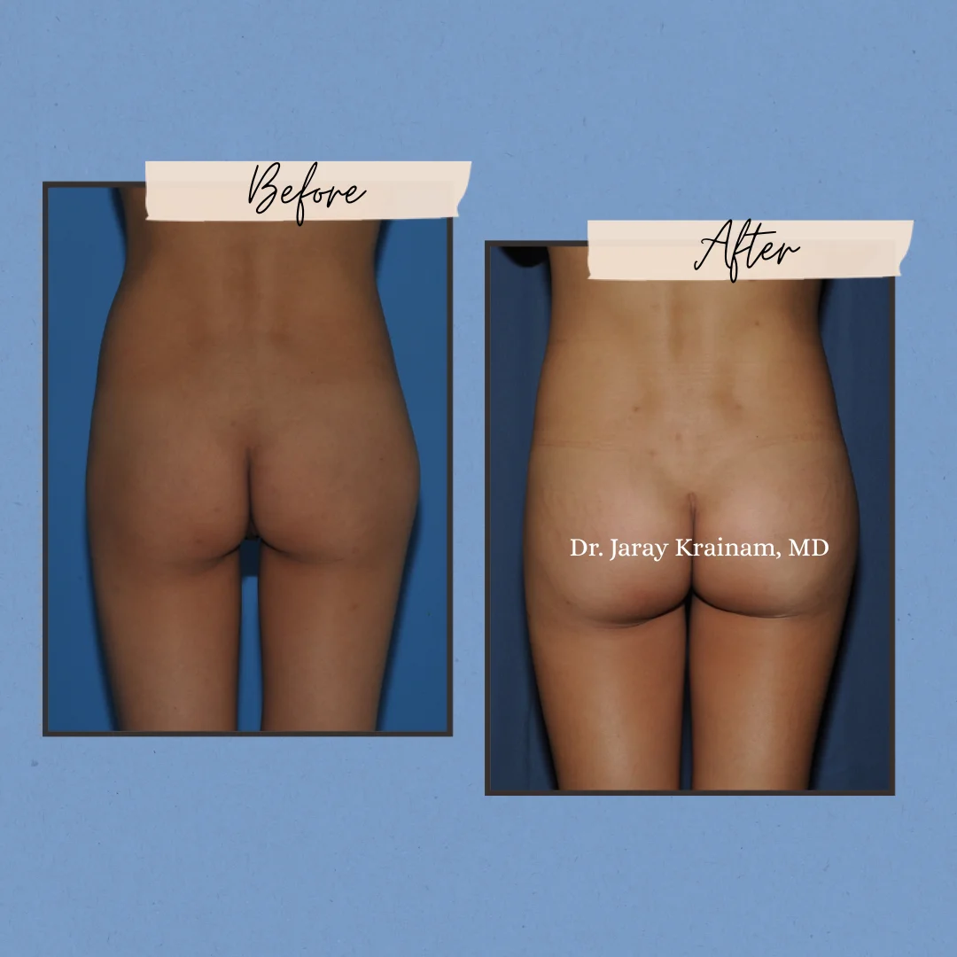 270 - Dr. Jaray Cosmetic Surgery