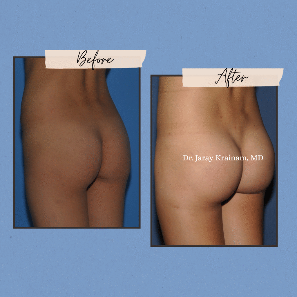 271 - Dr. Jaray Cosmetic Surgery