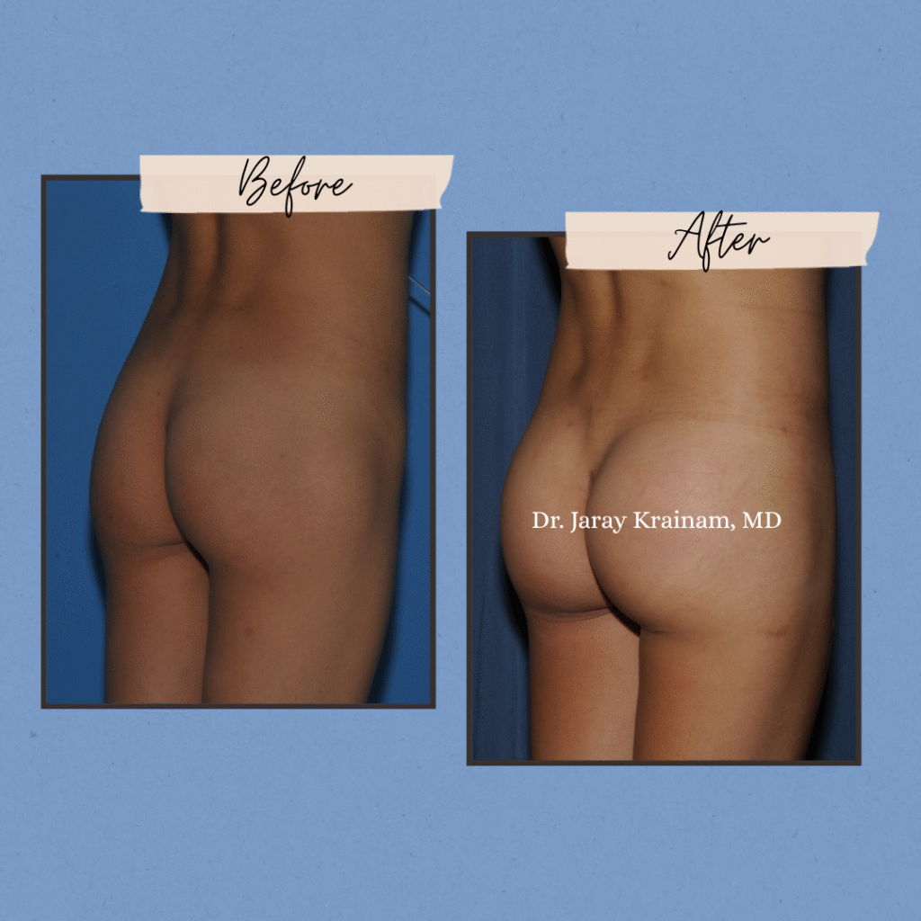 272 - Dr. Jaray Cosmetic Surgery