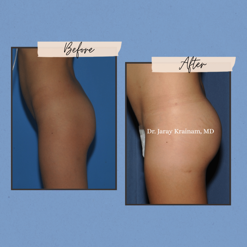 273 - Dr. Jaray Cosmetic Surgery