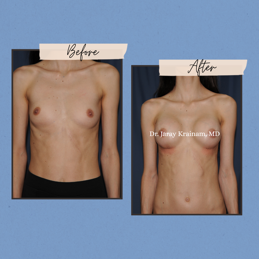 281 - Dr. Jaray Cosmetic Surgery