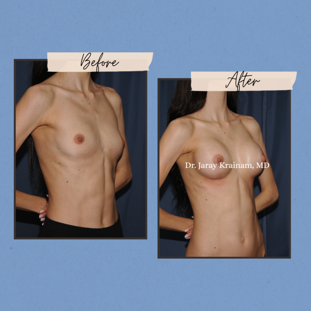 282 - Dr. Jaray Cosmetic Surgery