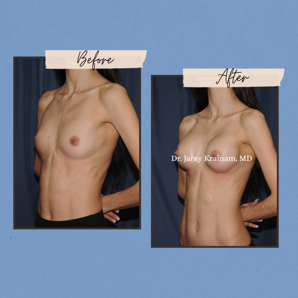 283 - Dr. Jaray Cosmetic Surgery