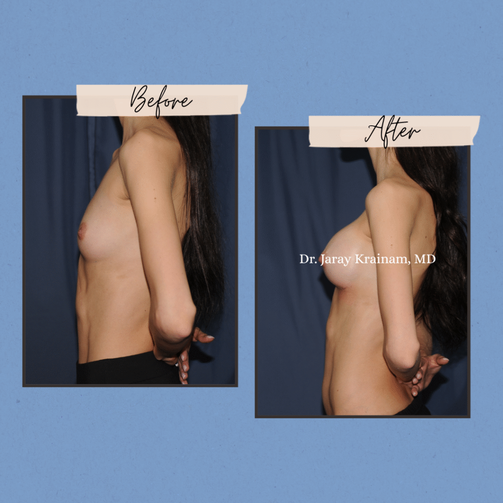 285 - Dr. Jaray Cosmetic Surgery