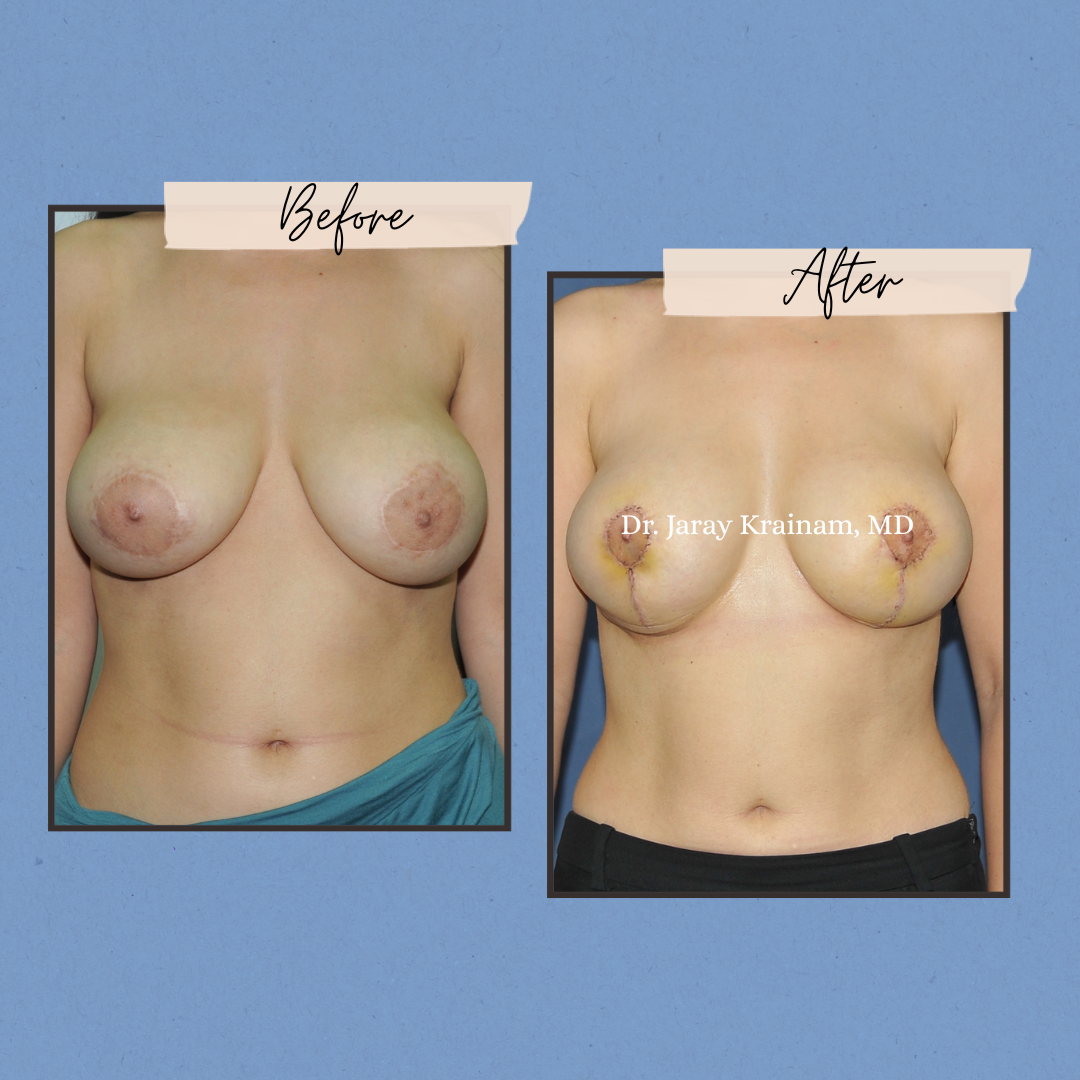 291 - Dr. Jaray Cosmetic Surgery