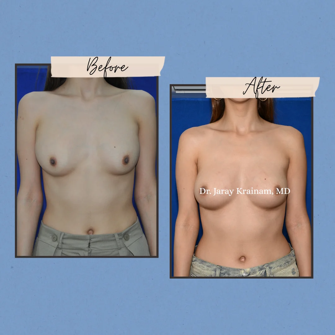 299 - Dr. Jaray Cosmetic Surgery