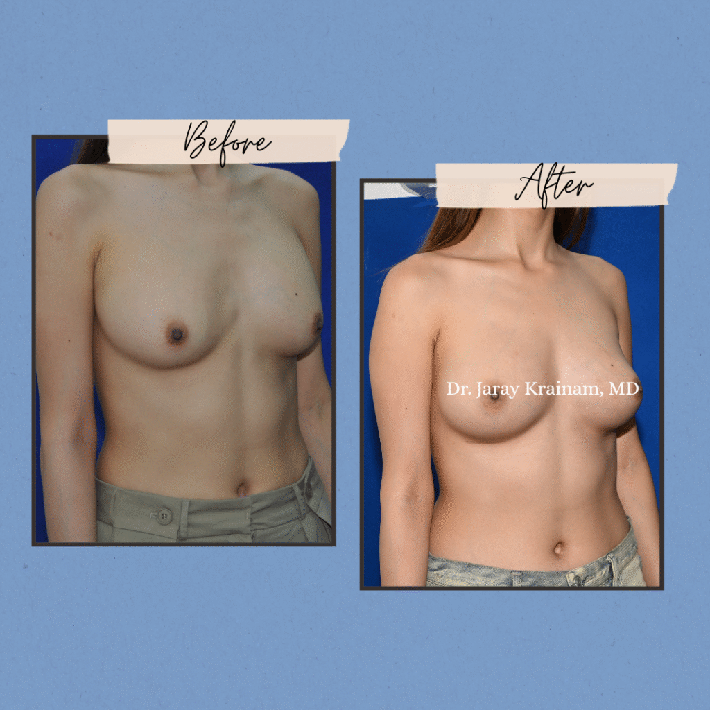 300 - Dr. Jaray Cosmetic Surgery