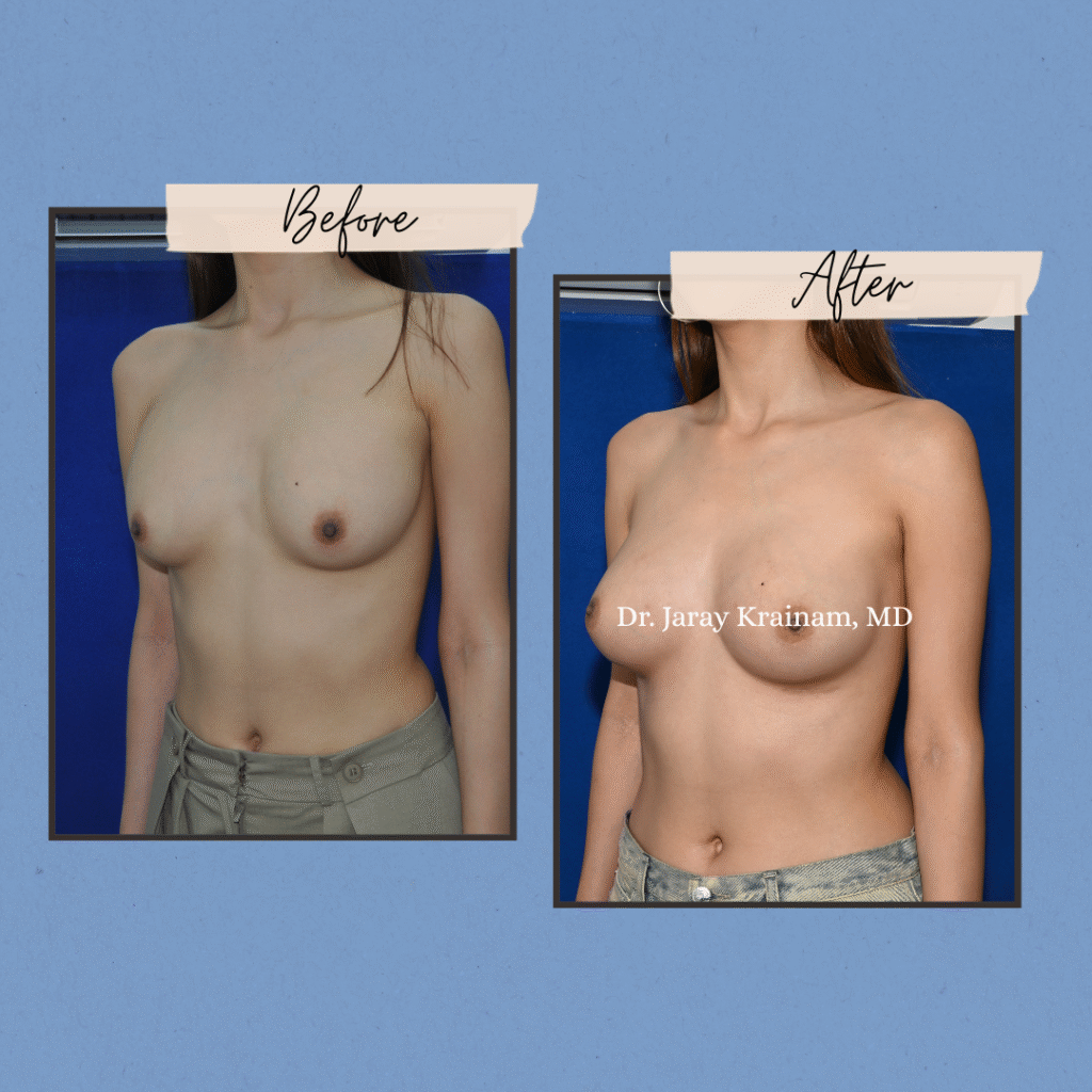 301 - Dr. Jaray Cosmetic Surgery