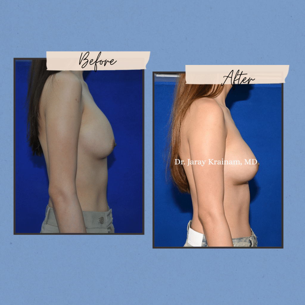 302 - Dr. Jaray Cosmetic Surgery