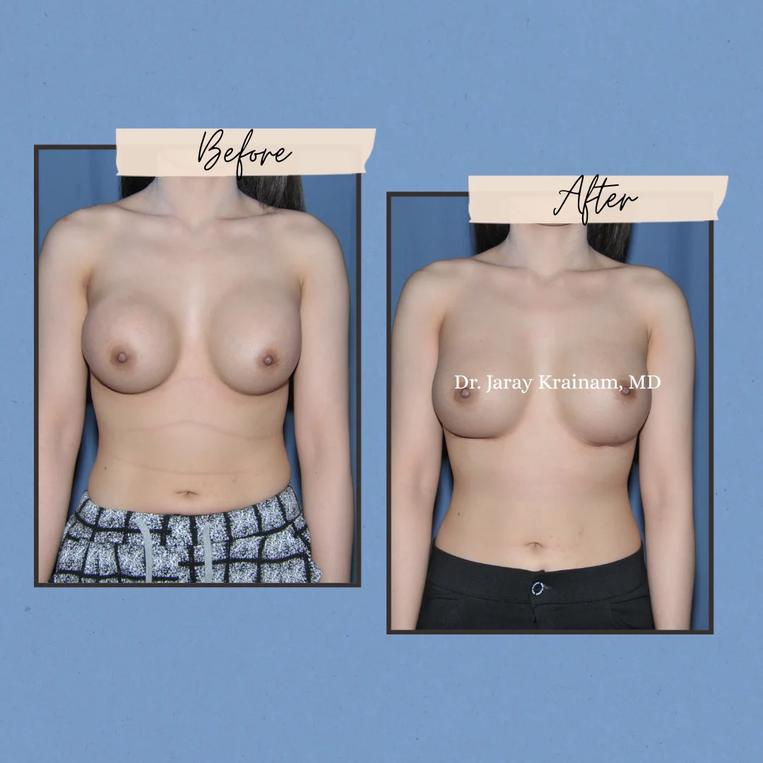 335 - Dr. Jaray Cosmetic Surgery