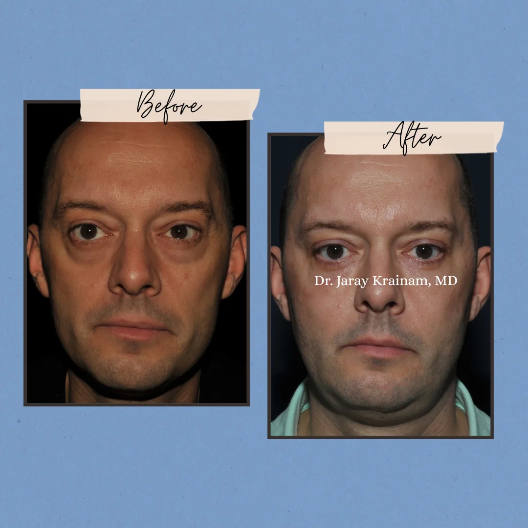 208 1 - Dr. Jaray Cosmetic Surgery