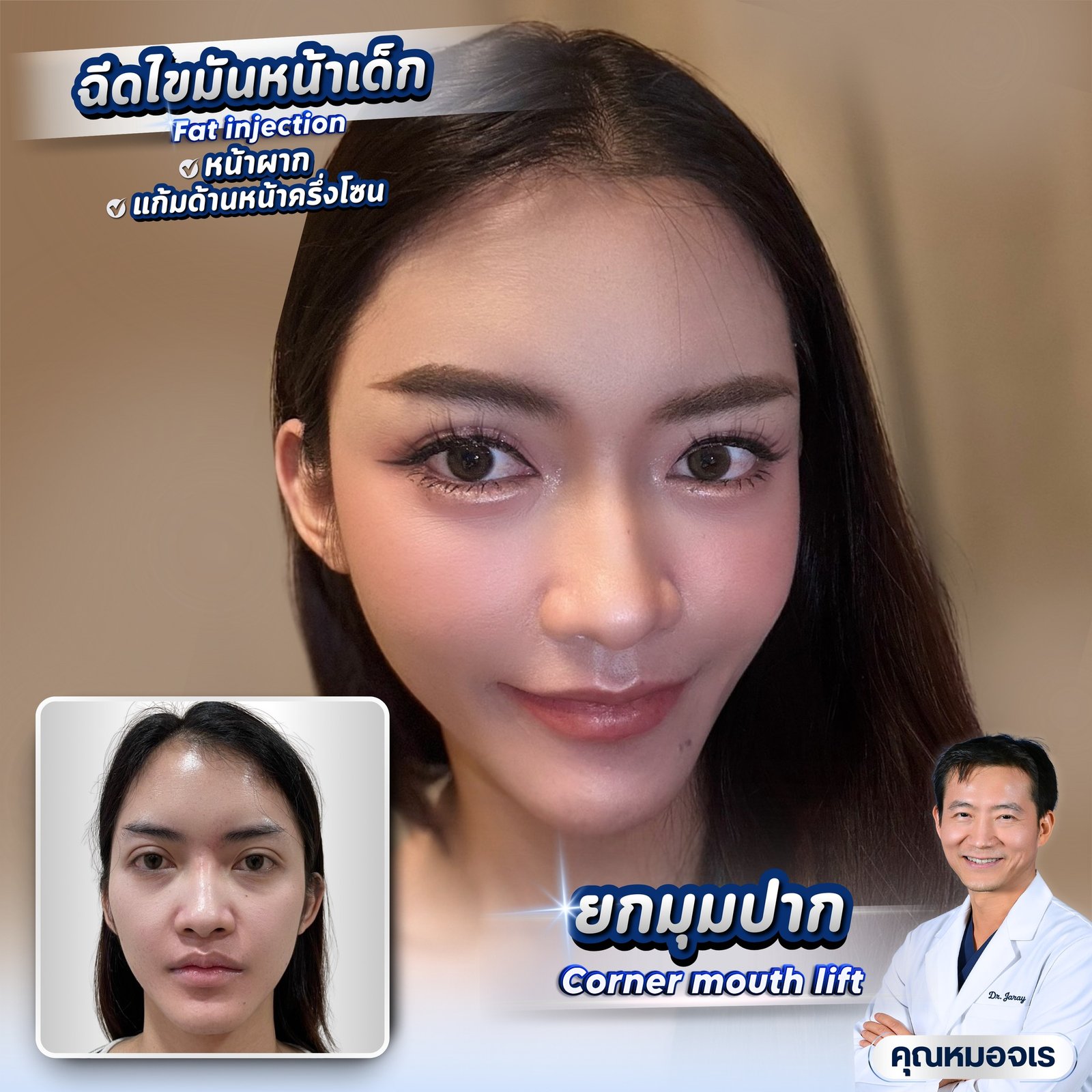 586154548_1268762868611185_3784201620319777491_n - Dr. Jaray Cosmetic Surgery