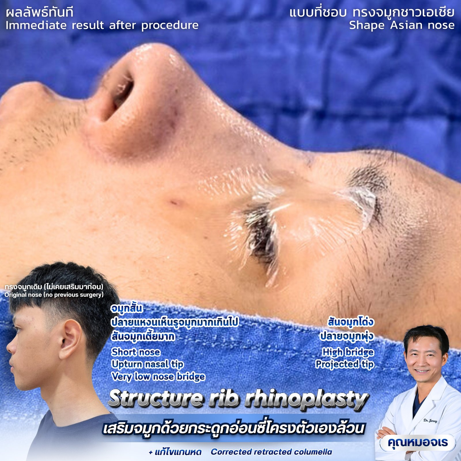 645770045_1352711630216308_7925221088751672567_n - Dr. Jaray Cosmetic Surgery