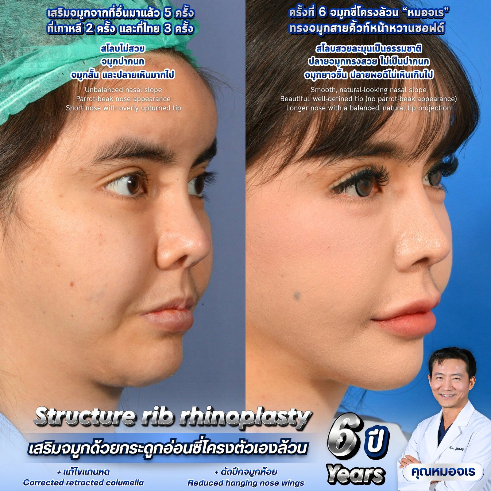 648842603_1355884889898982_8633741057320284869_n - Dr. Jaray Cosmetic Surgery
