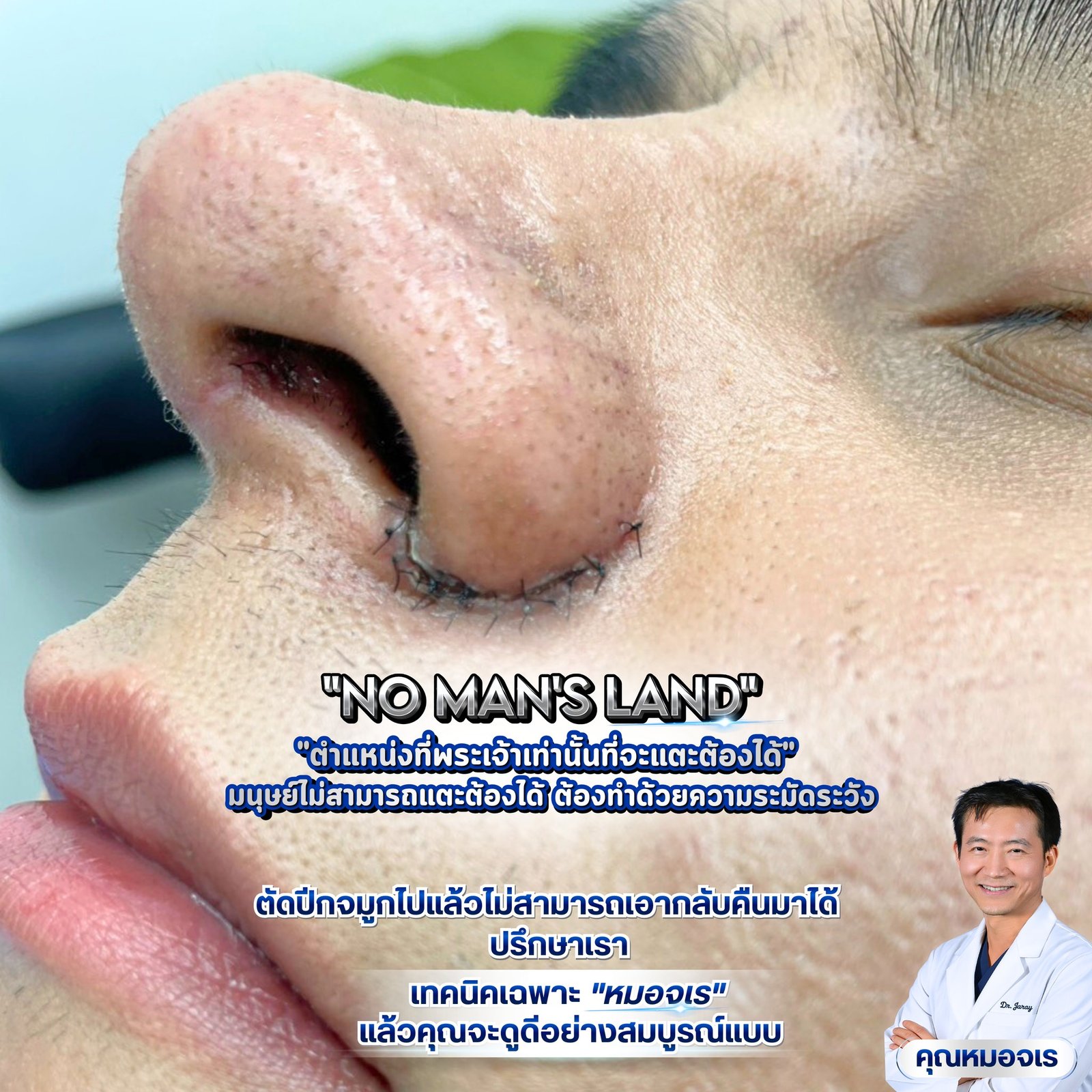 649982253_1359133596240778_4966953993409743317_n - Dr. Jaray Cosmetic Surgery