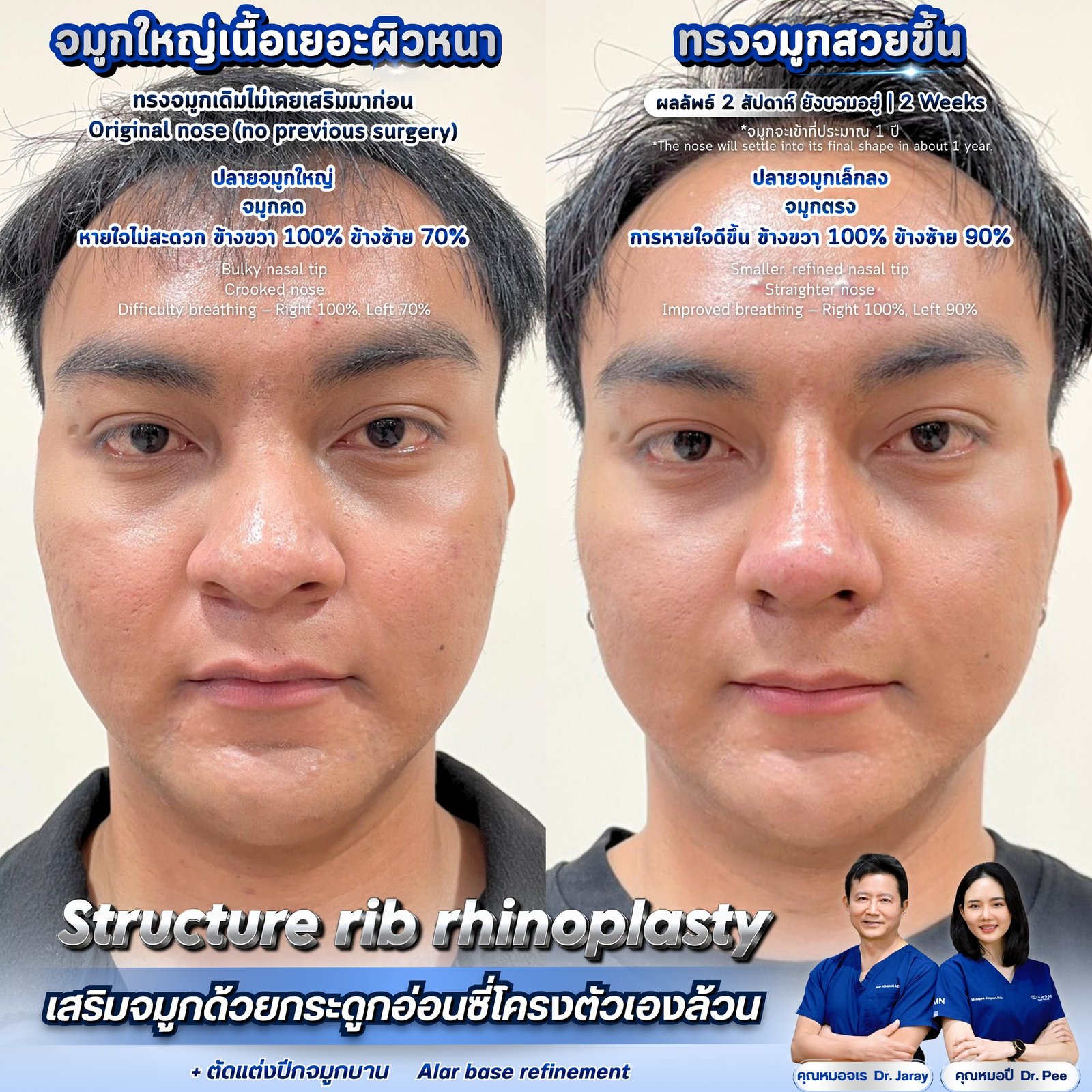 651901666_1359036159583855_5664539280796670532_n - Copy - Dr. Jaray Cosmetic Surgery