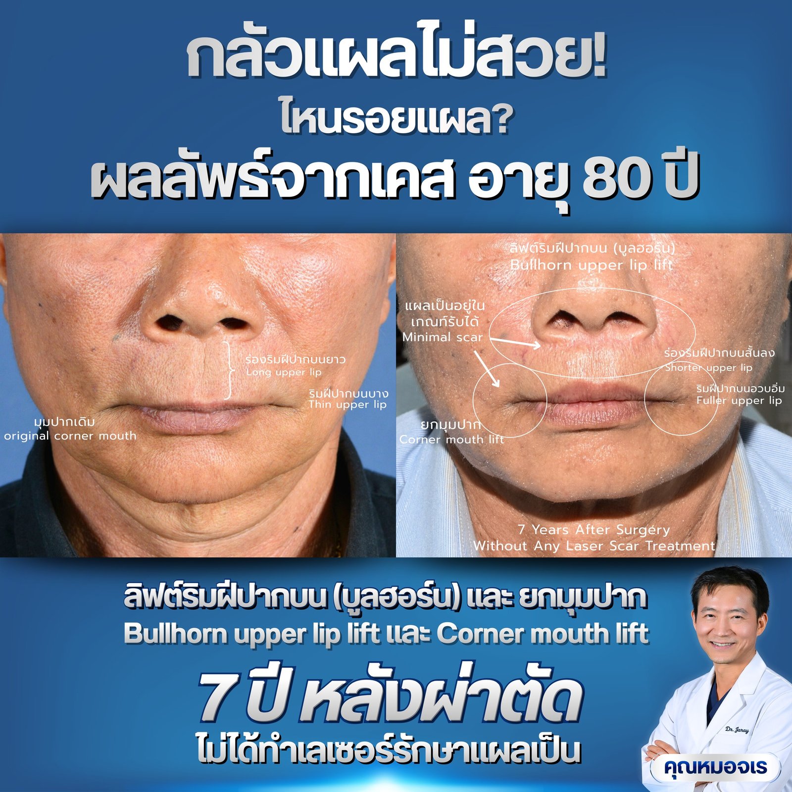 653711260_1363816382439166_1987115211981998151_n - Dr. Jaray Cosmetic Surgery